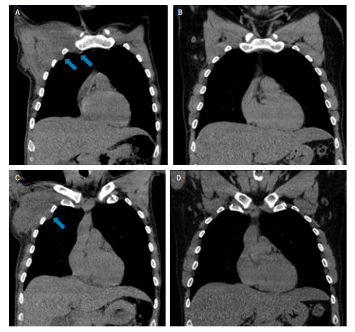 ny14_229570.png b4.png